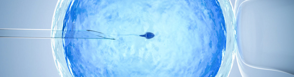 درمان ناباروری با IVF و آنچه باید در مورد آن بدانید درمان ناباروری با IVF و آنچه باید در مورد آن بدانید