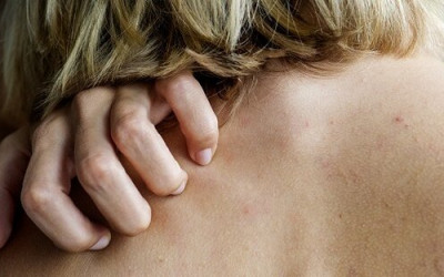 لوپوس در بارداری لوپوس در بارداری