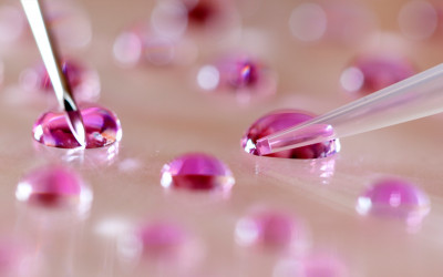 روش های تقویت رحم قبل از IVF روش های تقویت رحم قبل از IVF