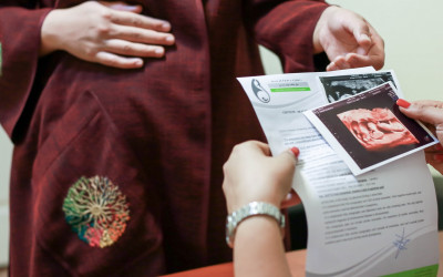 تفسیر سونوگرافی بیوفیزیکال جنین