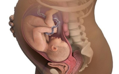 انواع وضعیت قرارگیری کودک هنگام تولد انواع وضعیت قرارگیری کودک هنگام تولد