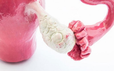 اهمیت اندازه تخمدان برای بارداری اهمیت اندازه تخمدان برای بارداری