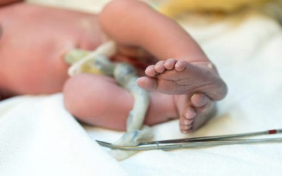 مزایا و معایب تاخیر در بریدن بند ناف