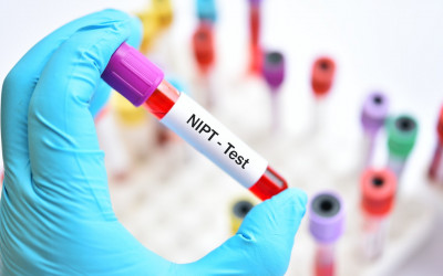 آزمایش غربالگری نیفتی و سل فری در بارداری و تفسیر آن