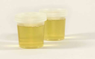 تست بارداری با جوش شیرین تست بارداری با جوش شیرین