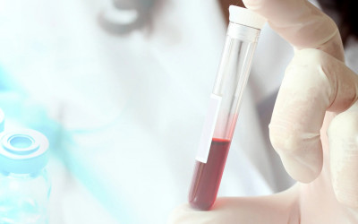 میزان پرولاکتین نرمال در بارداری چقدر است؟