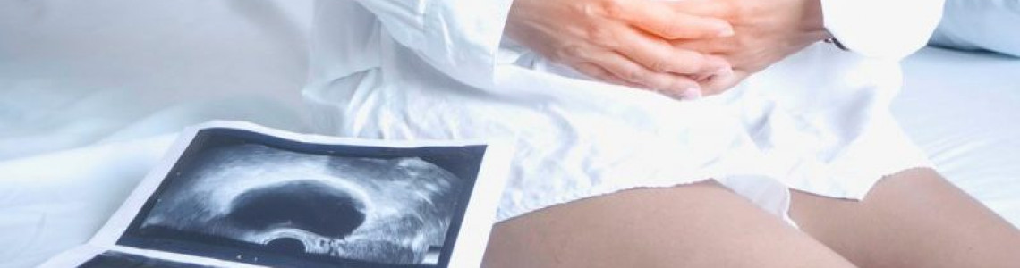 کیست نابوتین چه تاثیری بر بارداری دارد؟ کیست نابوتین چه تاثیری بر بارداری دارد؟
