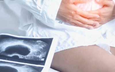 کیست نابوتین چه تاثیری بر بارداری دارد؟ کیست نابوتین چه تاثیری بر بارداری دارد؟