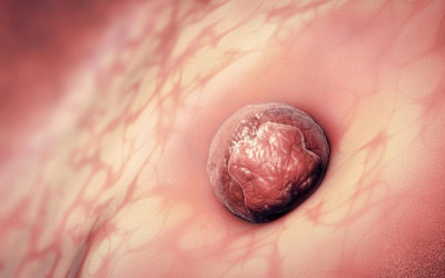 علائم لانه گزینی