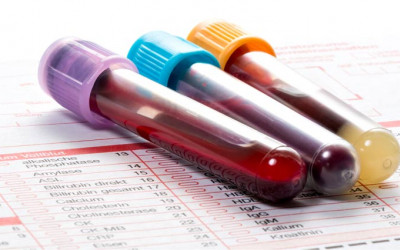 آزمایش غربالگری سه ماهه اول بارداری