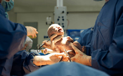 عمل جراحی سزارین عمل جراحی سزارین