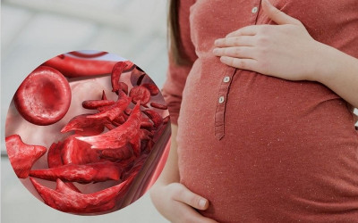 آنمی در دوران بارداری آنمی در دوران بارداری