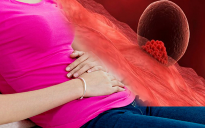 دلایل خونریزی در دوران بارداری دلایل خونریزی در دوران بارداری