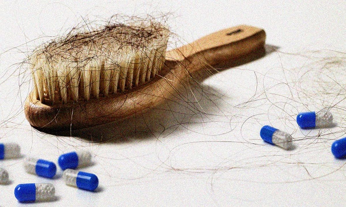 رفع ریزش مو پس از بارداری