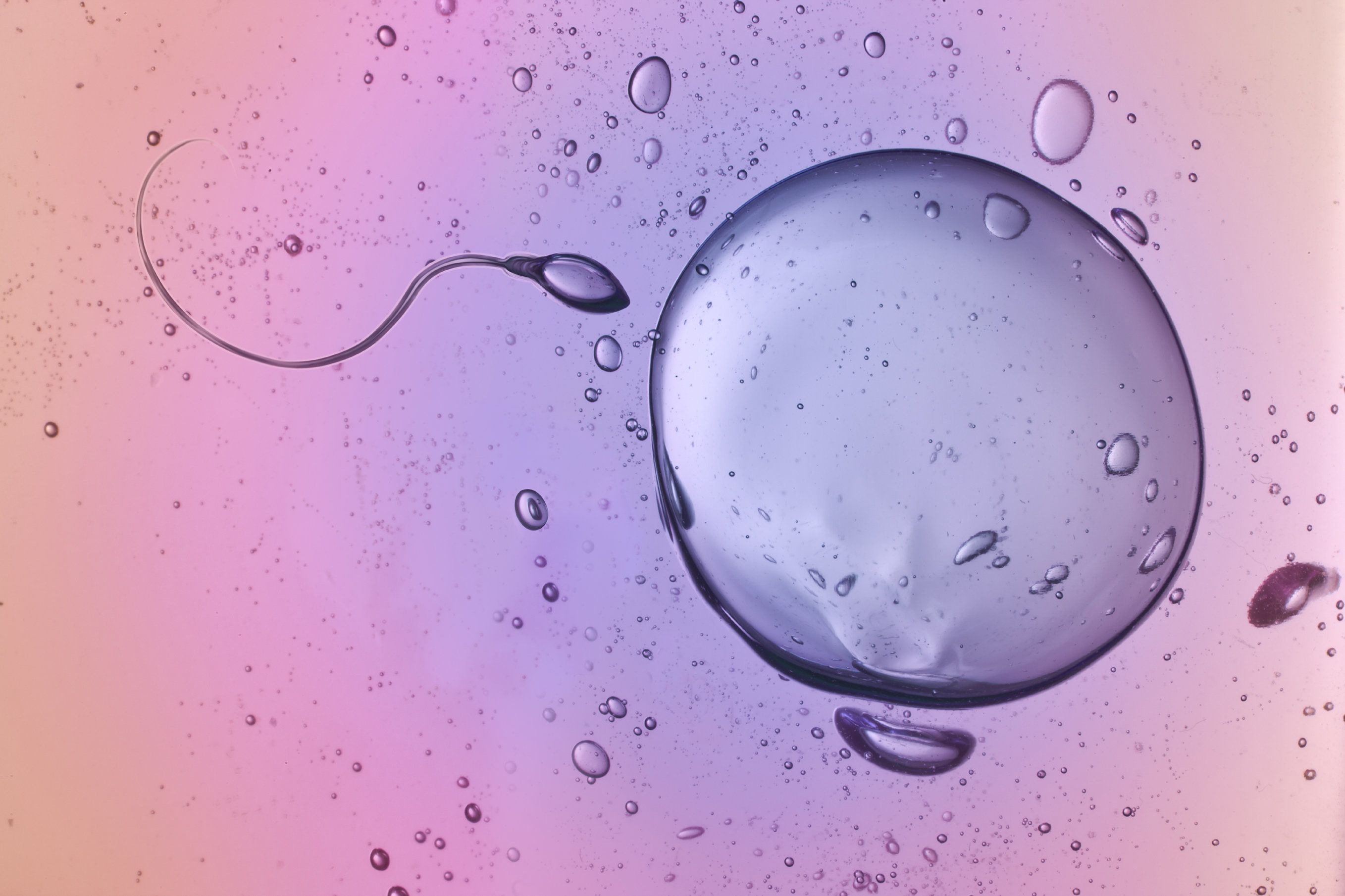 روش IVF برای درمان ناباروری