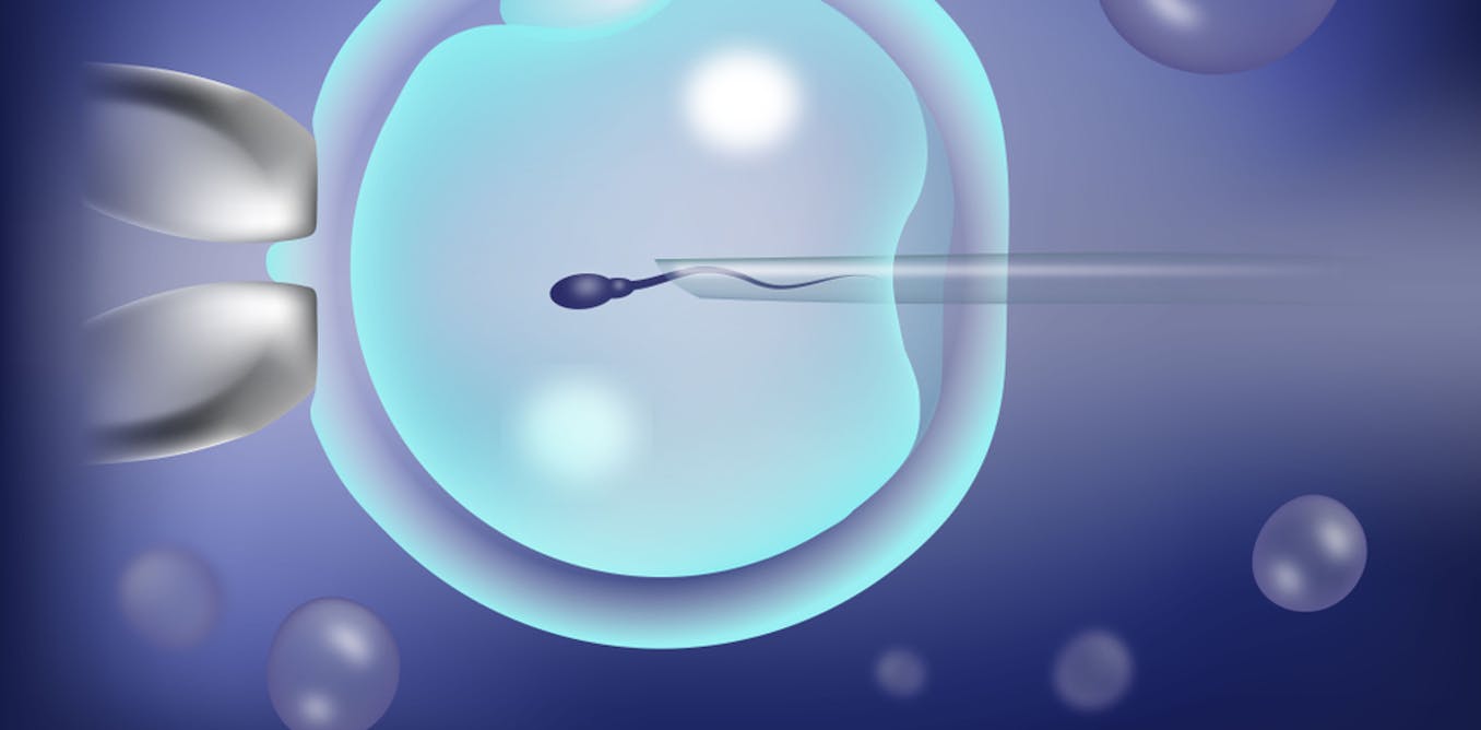 تقویت اسپرم قبل از IVF