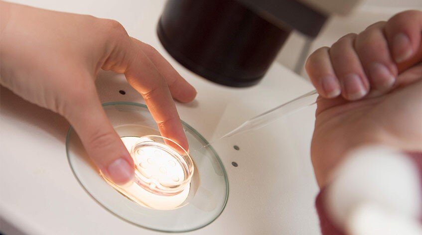 ivf در آزمایشگاه
