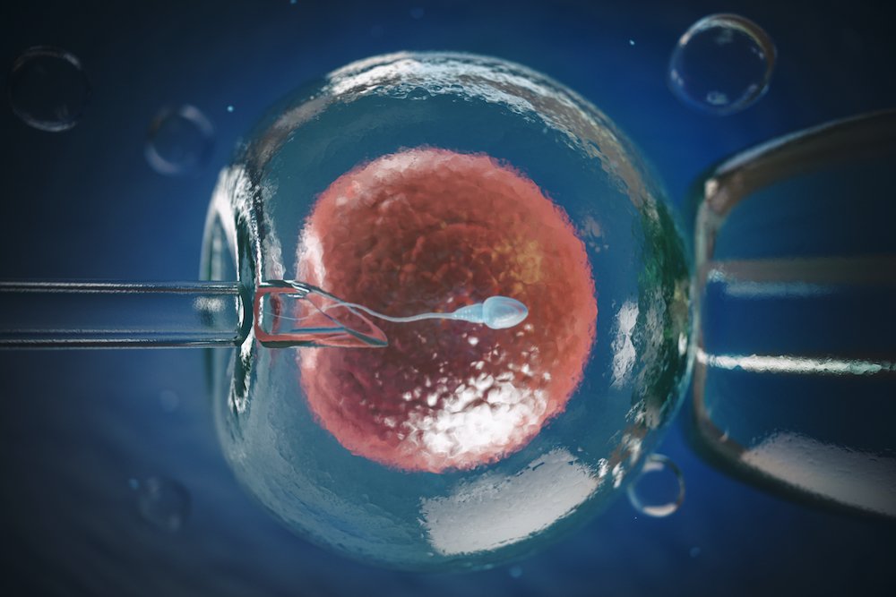 آی وی اف (IVF)